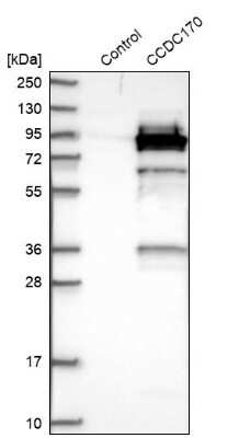 Western Blot: CCDC170 Antibody [NBP2-48579]