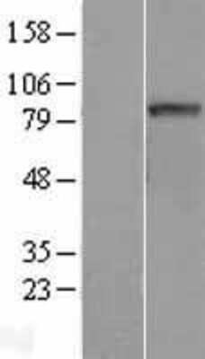 Western Blot: CCDC170 Overexpression Lysate [NBL1-08540]