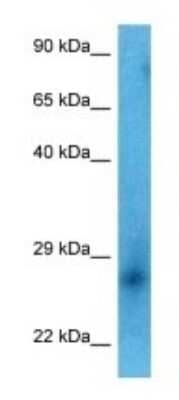 Western Blot: C6orf99 Antibody [NBP3-09915]