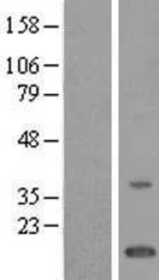 Western Blot: TMEM243 Overexpression Lysate [NBL1-08545]