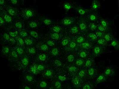 Immunocytochemistry/ Immunofluorescence: C7orf25 Antibody [NBP3-06256]