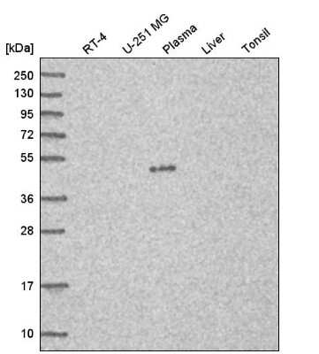 Western Blot: C7orf25 Antibody [NBP2-56786]