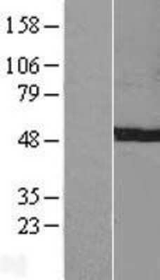 Western Blot: C7orf25 Overexpression Lysate [NBL1-08547]