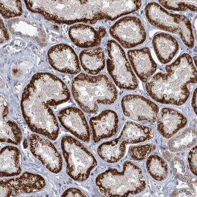 Immunohistochemistry-Paraffin: C7orf26 Antibody [NBP2-14764]