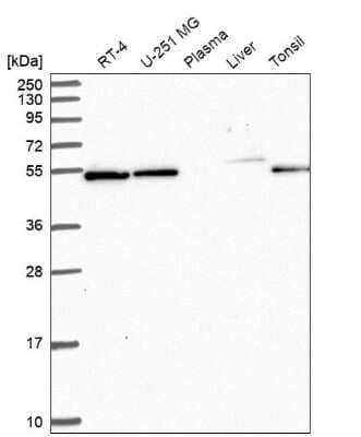 Western Blot: C7orf26 Antibody [NBP2-14764]