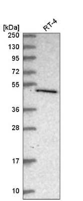 Western Blot: C7orf26 Antibody [NBP2-55233]