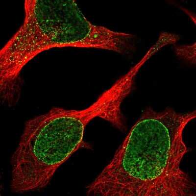 Immunocytochemistry/ Immunofluorescence: ZBED6 C-Terminal Like Antibody [NBP2-55582]