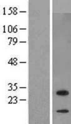 Western Blot: ZBED6 C-Terminal Like Overexpression Lysate [NBL1-08550]