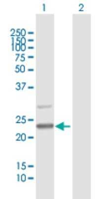 Western Blot: MALSU1 Antibody [H00115416-B01P]