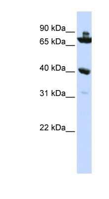 Western Blot: C7orf31 Antibody [NBP1-56351]