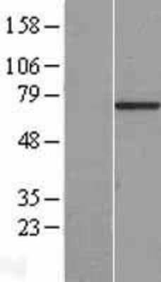 Western Blot: C7orf31 Overexpression Lysate [NBL1-08552]