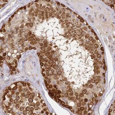 Immunohistochemistry-Paraffin: YAE1 Antibody [NBP2-33945]