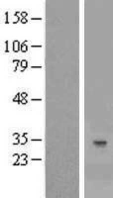 Western Blot: YAE1 Overexpression Lysate [NBL1-08554]