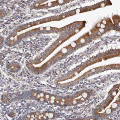 Immunohistochemistry-Paraffin: MAP11 Antibody [NBP1-83806]