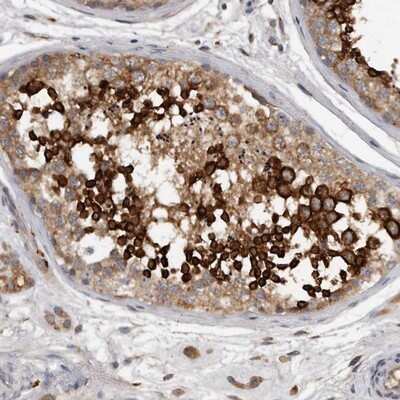 Immunohistochemistry-Paraffin: MAP11 Antibody [NBP1-83807]