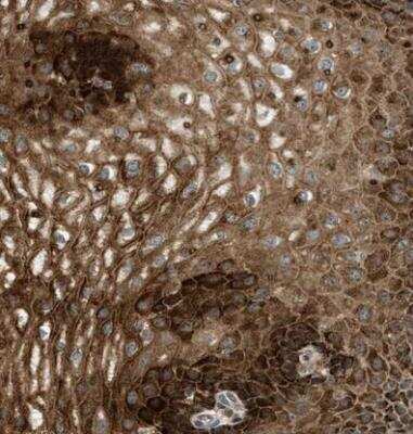 Immunohistochemistry-Paraffin: MAP11 Antibody [NBP1-83808]
