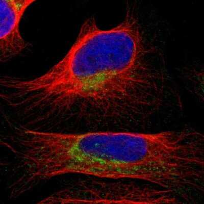 Immunocytochemistry/ Immunofluorescence: COA1 Antibody [NBP1-83830]