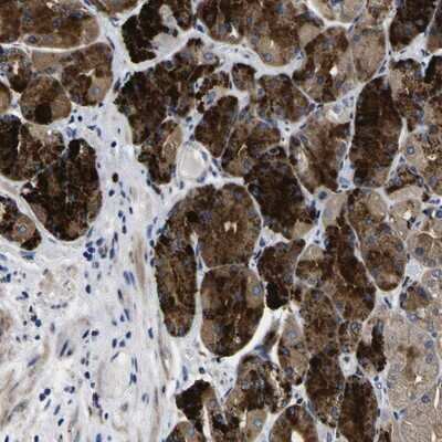 Immunohistochemistry-Paraffin: COA1 Antibody [NBP1-83830]