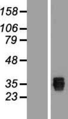 Western Blot: SSMEM1 Overexpression Lysate [NBL1-08557]