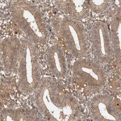 Immunohistochemistry-Paraffin: FAM221A Antibody [NBP1-90513]
