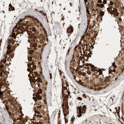 Immunohistochemistry-Paraffin: FAM221A Antibody [NBP1-90513]