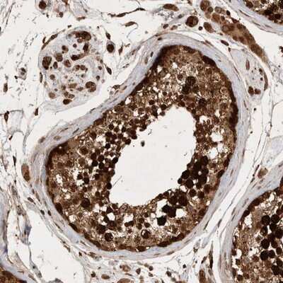 Immunohistochemistry-Paraffin: FAM221A Antibody [NBP1-90514]