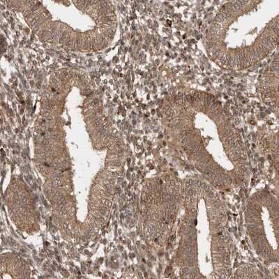 Immunohistochemistry-Paraffin: FAM221A Antibody [NBP1-90514]