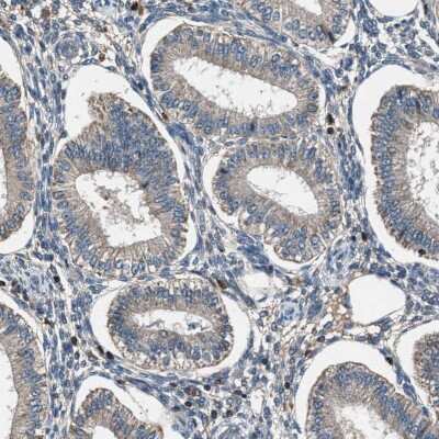 Immunohistochemistry-Paraffin: FAM221A Antibody [NBP1-90515]