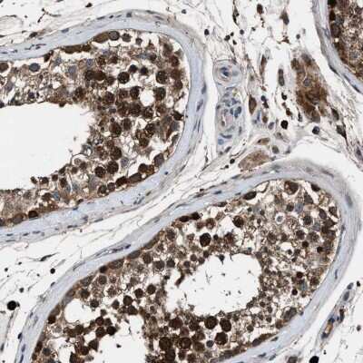 Immunohistochemistry-Paraffin: FAM221A Antibody [NBP1-90515]