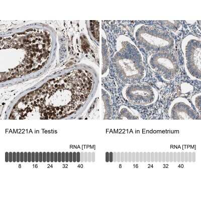 Immunohistochemistry-Paraffin: FAM221A Antibody [NBP1-90515]