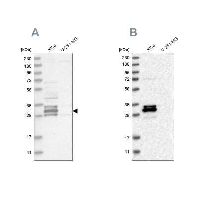 Western Blot: FAM221A Antibody [NBP1-90513]