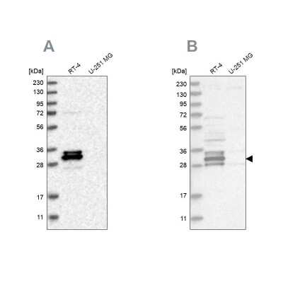 Western Blot: FAM221A Antibody [NBP1-90514]