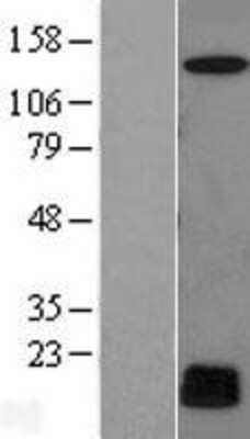 Western Blot: CYREN Overexpression Lysate [NBL1-08558]