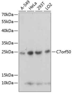 Western Blot: C7orf50 AntibodyAzide and BSA Free [NBP2-92744]