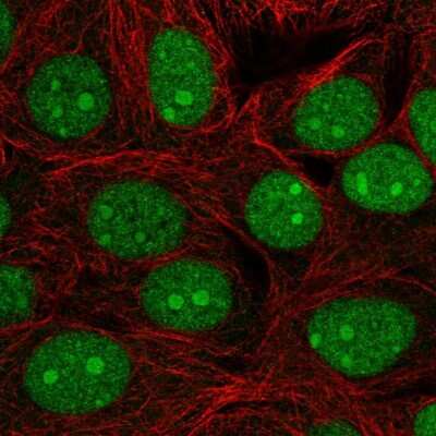 Immunocytochemistry/ Immunofluorescence: C7orf50 Antibody [NBP2-30873]