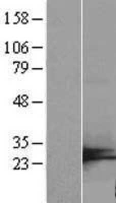 Western Blot: C7orf50 Overexpression Lysate [NBL1-08559]