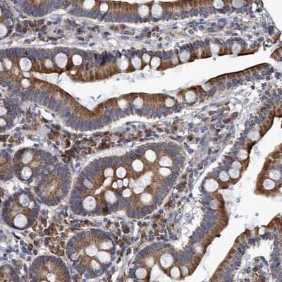 Immunohistochemistry-Paraffin: NAT16 Antibody [NBP1-93791]