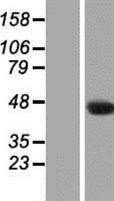 Western Blot: NAT16 Overexpression Lysate [NBP2-04683]