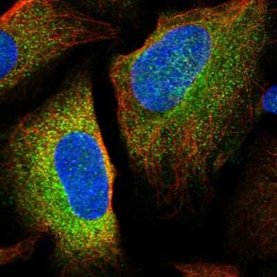 Immunocytochemistry/ Immunofluorescence: LSMEM1 Antibody [NBP2-56542]