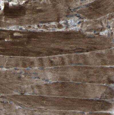 Immunohistochemistry-Paraffin: LSMEM1 Antibody [NBP1-81923]