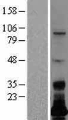 Western Blot: LSMEM1 Overexpression Lysate [NBL1-08560]