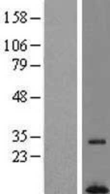 Western Blot: HSPC268 Overexpression Lysate [NBL1-08562]