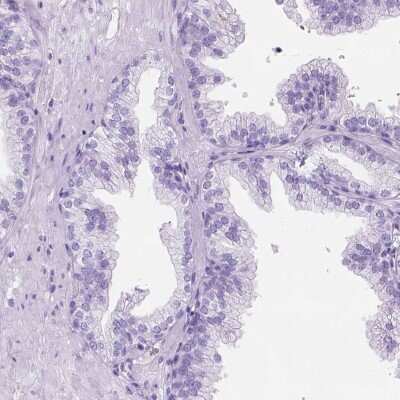 Immunohistochemistry-Paraffin: C7orf57 Antibody [NBP1-91074]