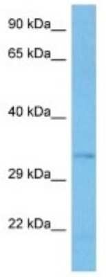 Western Blot: C7orf57 Antibody [NBP3-10856]