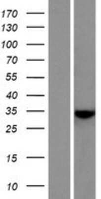 Western Blot: C7orf57 Overexpression Lysate [NBP2-08250]