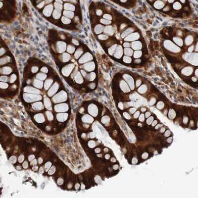 Immunohistochemistry-Paraffin: CPED1 Antibody [NBP1-93947]