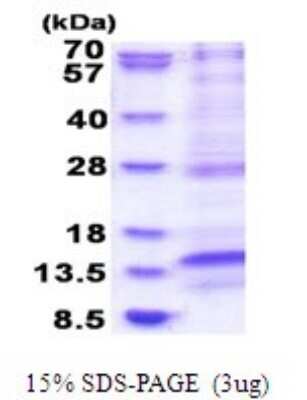 SDS-PAGE: Recombinant Human LAMTOR4 His Protein [NBP2-51803]