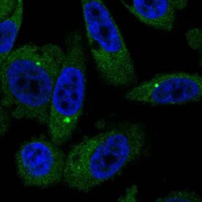 Immunocytochemistry/ Immunofluorescence: SAMTOR Antibody [NBP2-58198]