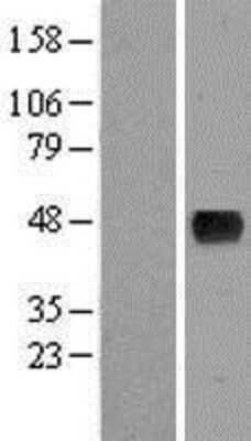 Western Blot: SAMTOR Overexpression Lysate [NBP2-05347]