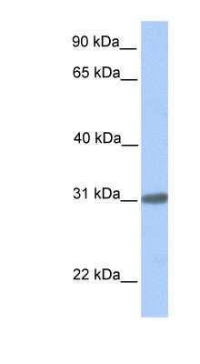 Western Blot: C7orf61 Antibody [NBP1-56948]